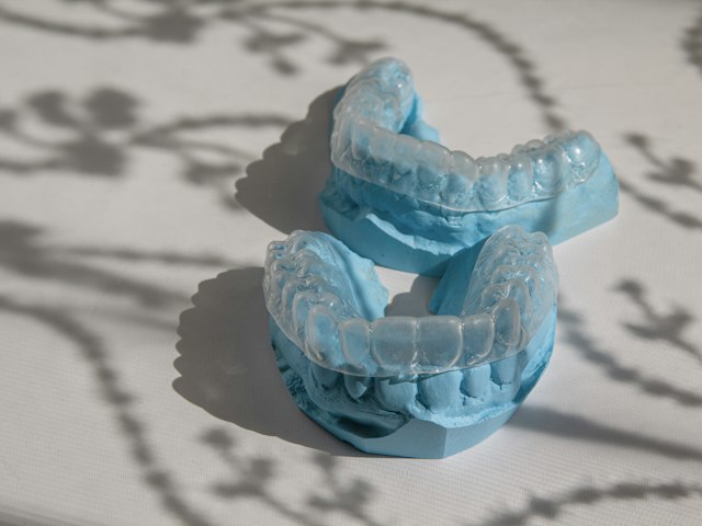 3D printed dental aligner models